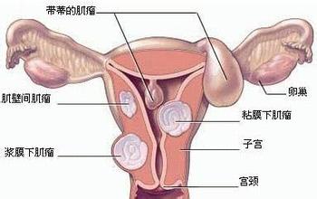 ӹΣʲô